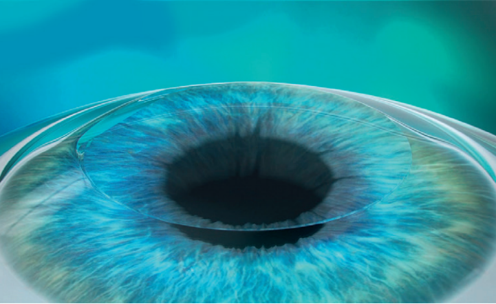 Lasik Portland, lasik eye surgery Portland, lasik surgery Portland, laser eye surgery Portland, best lasik in Portland, best lasik in Portland, lasik Portland cost, eye surgery Portland Oregon, mehrdad malihi, mehrdad malihi MD, Dr. Mehrdad Malihi, mehrdad malihi md, Dr Mehrdad Malihi ophthalmologist, Dr Mehrdad Malihi MD opthalmoology specialist, Opthalmogoly speciaslist Portland, eye laser surgery Portland, laser surgery Portland, eye surgery Portland, lasik eye surgery cost Portland, Portland lasik special, Portland lasik eye center, Portland lasik doctors, lasik Portland Oregon cost, eye cataract Portland, cataract vision Portland, cataract eye surgery Portland, cataracts treatment Portland, cataract Portland, macular degeneration Portland, amd Portland, diabetic retinopathy Portland, retinal vein occlusion Portland, rvo Portland, floaters and flashes Portland, floaters & flashes Portland, retinal tear or detachment Portland, macular hole portland