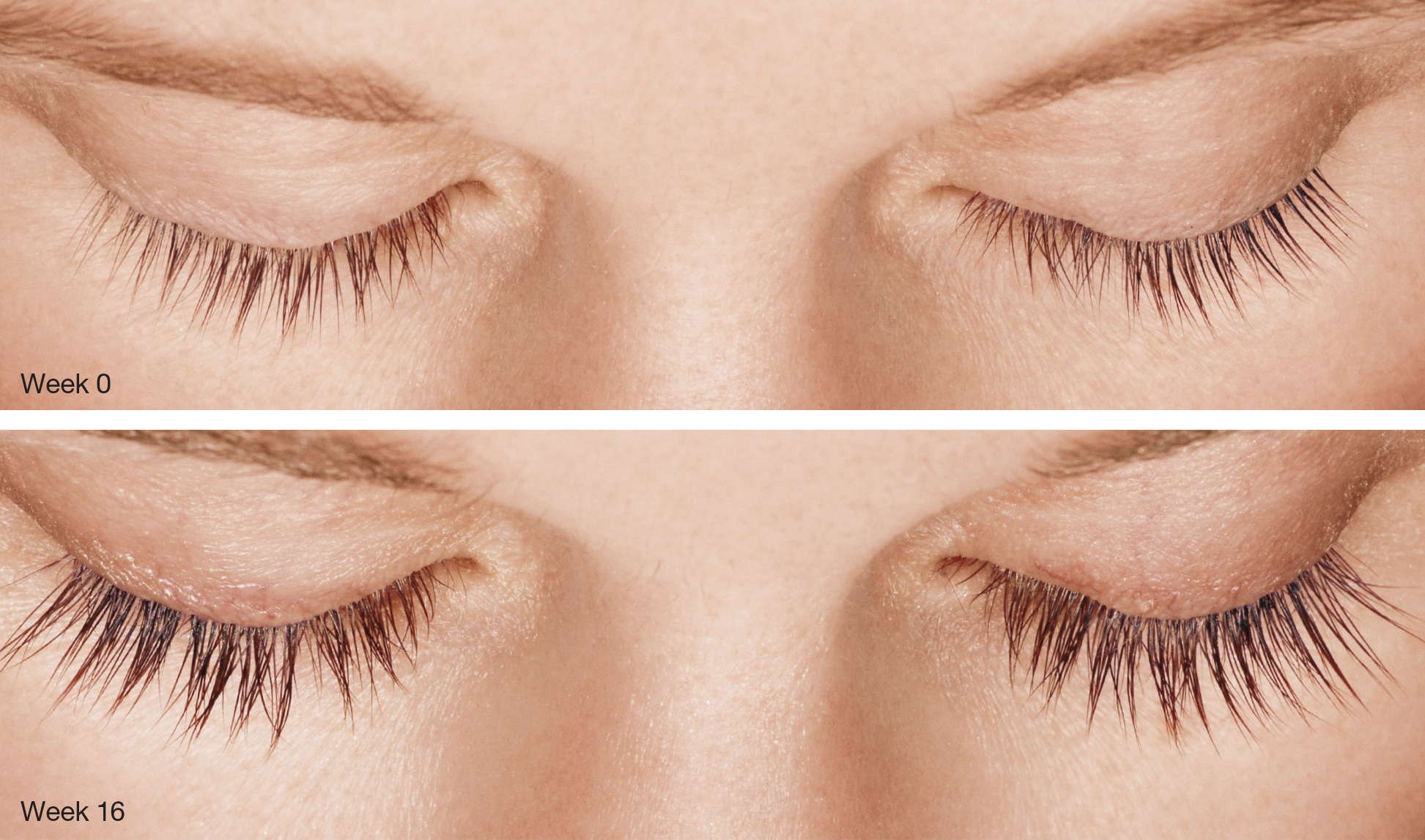Image20201230114954 Lasik Portland, lasik eye surgery Portland, lasik surgery Portland, laser eye surgery Portland, best lasik in Portland, best lasik in Portland, lasik Portland cost, eye surgery Portland Oregon, mehrdad malihi, mehrdad malihi MD, Dr. Mehrdad Malihi, mehrdad malihi md, Dr Mehrdad Malihi ophthalmologist, Dr Mehrdad Malihi MD opthalmoology specialist, Opthalmogoly speciaslist Portland, eye laser surgery Portland, laser surgery Portland, eye surgery Portland, lasik eye surgery cost Portland, Portland lasik special, Portland lasik eye center, Portland lasik doctors, lasik Portland Oregon cost, eye cataract Portland, cataract vision Portland, cataract eye surgery Portland, cataracts treatment Portland, cataract Portland, macular degeneration Portland, amd Portland, diabetic retinopathy Portland, retinal vein occlusion Portland, rvo Portland, floaters and flashes Portland, floaters & flashes Portland, retinal tear or detachment Portland, macular hole portland